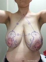 Free porn pics of Macromastia Gigantomastia 61 of 624 pics