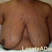 Free porn pics of Macromastia Gigantomastia 8 of 624 pics