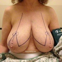 Free porn pics of Macromastia Gigantomastia 84 of 624 pics
