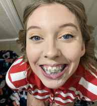 Free porn pics of Yellow teeth 2 72 of 199 pics