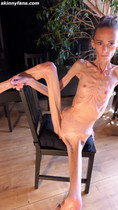 Free porn pics of Denisa - anorexic skinny fragile mager duenn knochig bones 43 9 of 40 pics