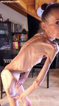 Free porn pics of Denisa - anorexic skinny fragile mager duenn knochig bones 43 4 of 40 pics
