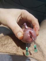 Free porn pics of Needles and pins in cocks and balls best of the web 3 10 of 111 pics