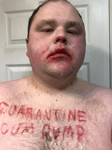 Free porn pics of Kentucky Faggot 25 of 284 pics
