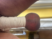Free porn pics of Balls bandage bound and blue 22 of 29 pics