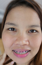 Free porn pics of Yellow teeth 2 65 of 199 pics
