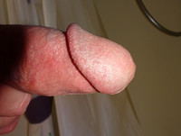 Free porn pics of Dick pics and other parts 13 of 219 pics