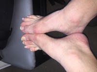 Free porn pics of My Feet 2.0 24 of 61 pics